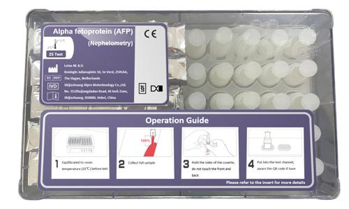 Alpha Fetoprotein (AFP) Test